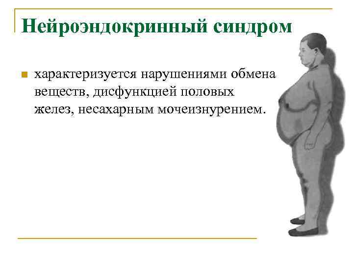 Нейроэндокринный синдром n характеризуется нарушениями обмена веществ, дисфункцией половых желез, несахарным мочеизнурением. 