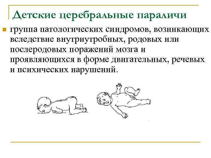 Детские церебральные параличи n группа патологических синдромов, возникающих вследствие внутриутробных, родовых или послеродовых поражений