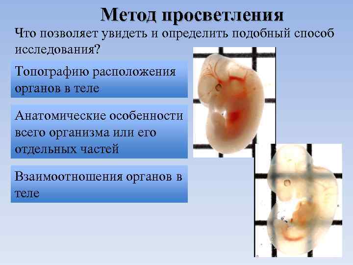 Метод просветления Что позволяет увидеть и определить подобный способ исследования? Топографию расположения органов в