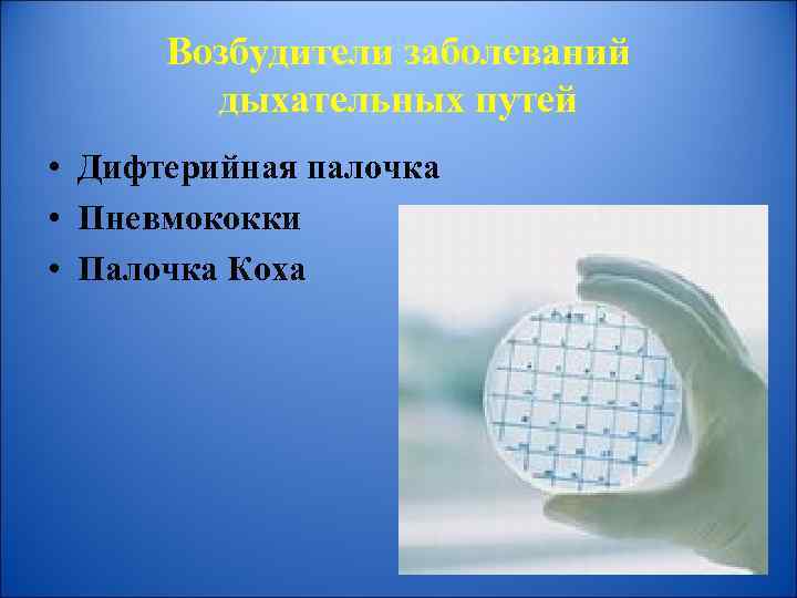 Возбудители заболеваний дыхательных путей • Дифтерийная палочка • Пневмококки • Палочка Коха 