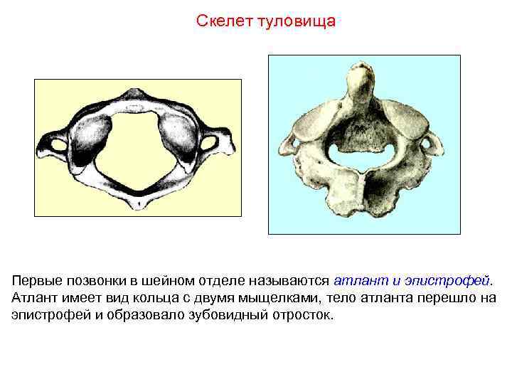 Скелет туловища Первые позвонки в шейном отделе называются атлант и эпистрофей. Атлант имеет вид