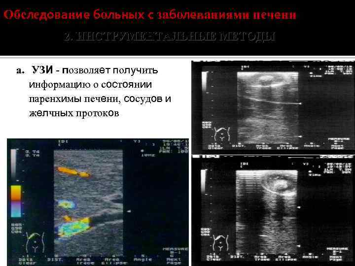 Обследование больных с заболеваниями печени 2. ИНСТРУМЕНТАЛЬНЫЕ МЕТОДЫ а. УЗИ - позволяет получить информацию