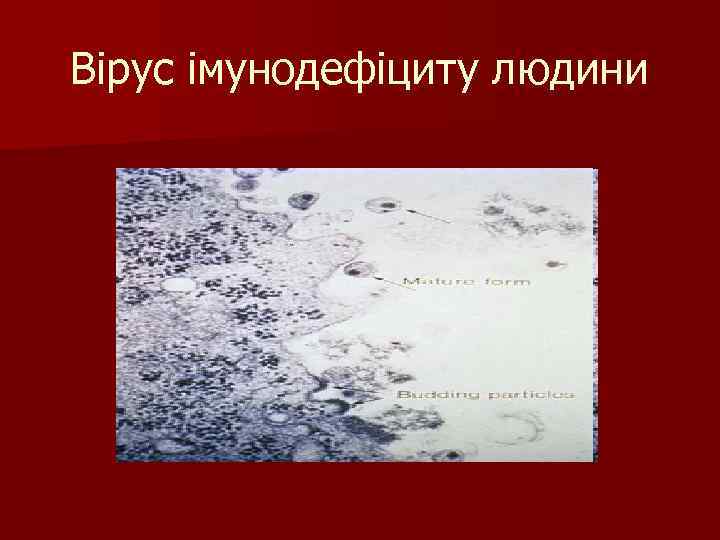 Вірус імунодефіциту людини 