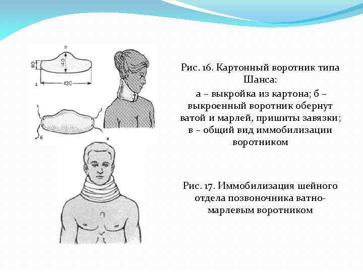 Транспортная иммобилизация шейный отдел позвоночника