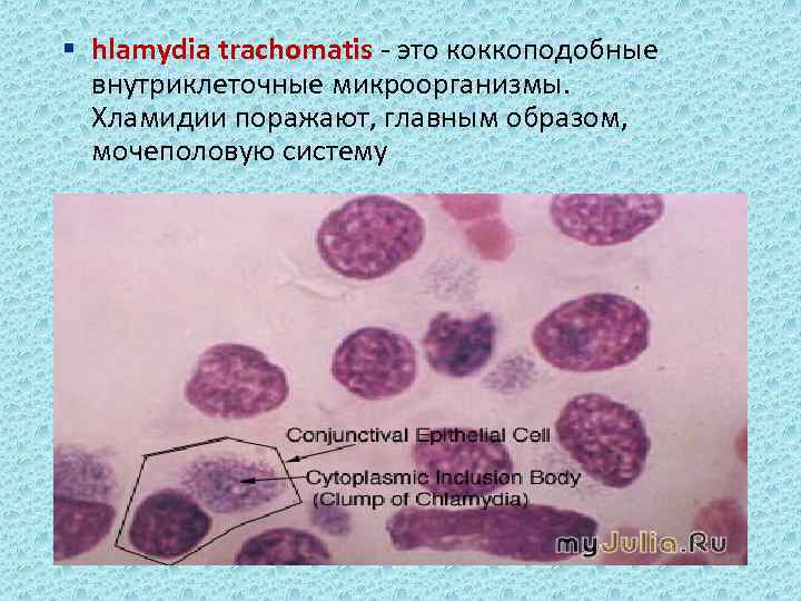 § hlamydia trachomatis - это коккоподобные внутриклеточные микроорганизмы. Хламидии поражают, главным образом, мочеполовую систему