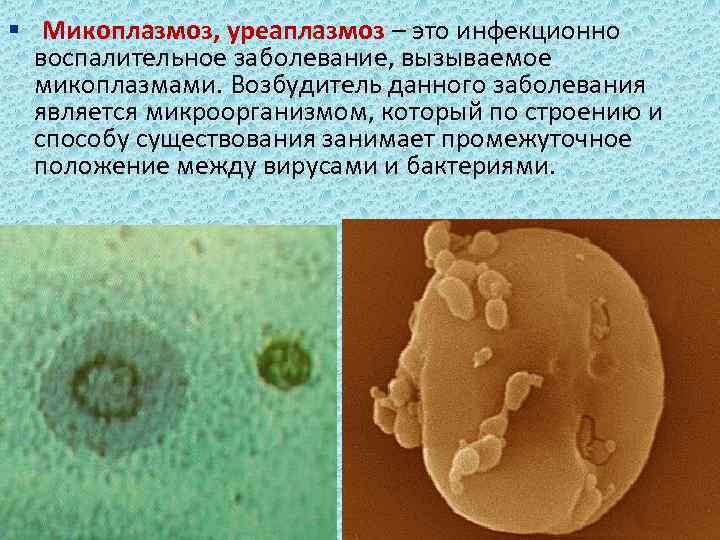 § Микоплазмоз, уреаплазмоз – это инфекционно воспалительное заболевание, вызываемое микоплазмами. Возбудитель данного заболевания является