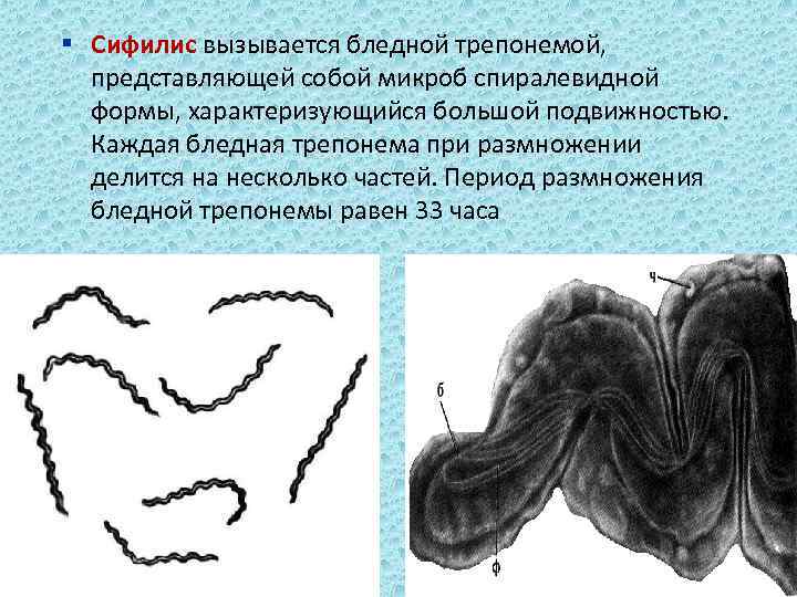 § Сифилис вызывается бледной трепонемой, представляющей собой микроб спиралевидной формы, характеризующийся большой подвижностью. Каждая