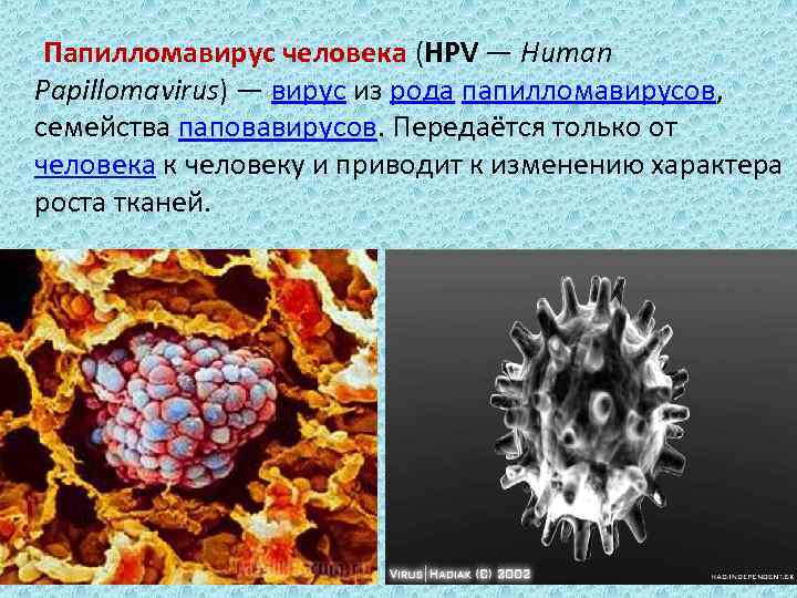 Папилломавирус человека (HPV — Human Papillomavirus) — вирус из рода папилломавирусов, семейства паповавирусов. Передаётся