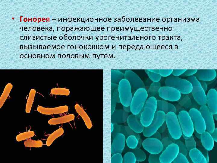  • Гонорея – инфекционное заболевание организма человека, поражающее преимущественно слизистые оболочки урогенитального тракта,