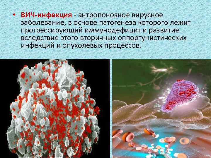  • ВИЧ-инфекция - антропонозное вирусное заболевание, в основе патогенеза которого лежит прогрессирующий иммунодефицит