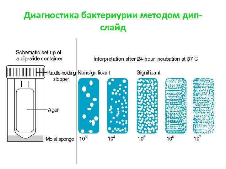 Диагностика бактериурии методом дипслайд 