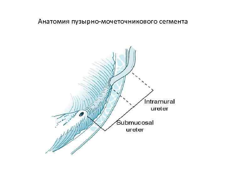 Анатомия пузырно-мочеточникового сегмента 