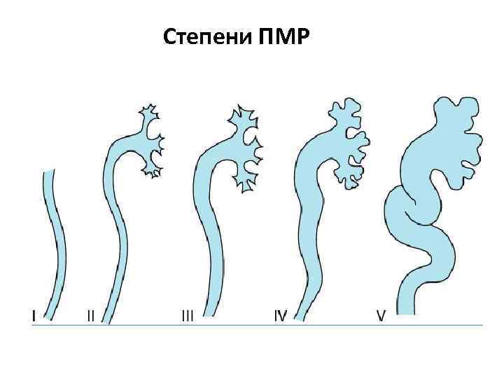 Степени ПМР 