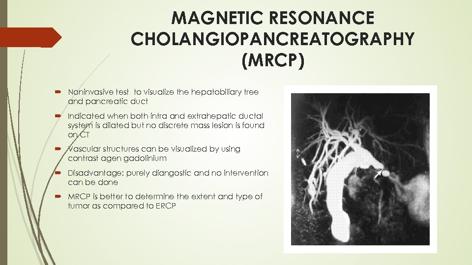 MAGNETIC RESONANCE CHOLANGIOPANCREATOGRAPHY (MRCP) Noninvasive test to visualize the hepatobiliary tree and pancreatic duct
