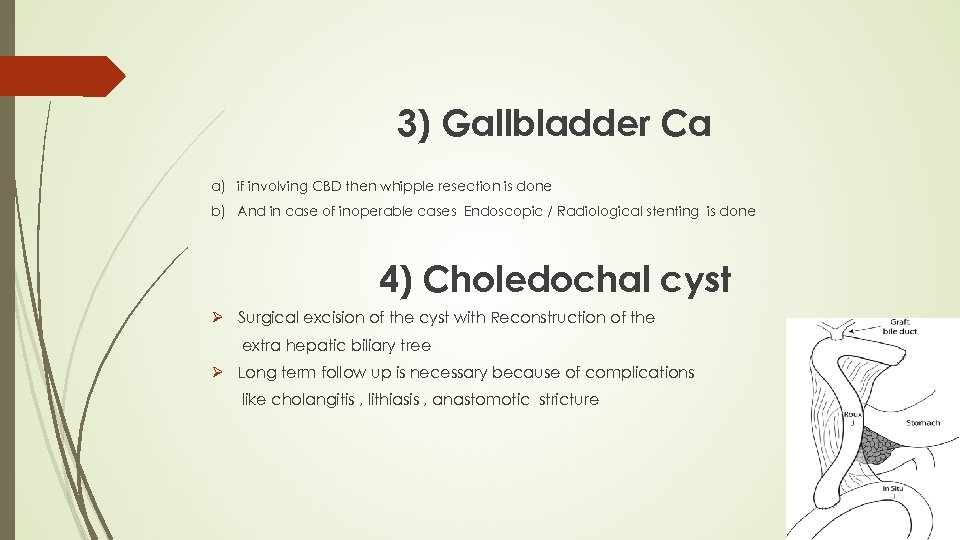3) Gallbladder Ca a) if involving CBD then whipple resection is done b) And