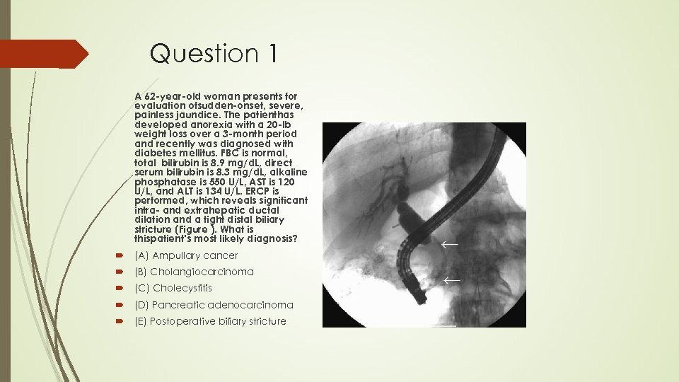 Question 1 A 62 -year-old woman presents for evaluation ofsudden-onset, severe, painless jaundice. The
