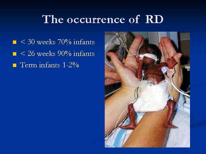 The occurrence of RD n n n < 30 weeks 70% infants < 26
