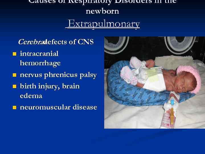 Causes of Respiratory Disorders in the newborn Extrapulmonary Cerebral defects of CNS n n