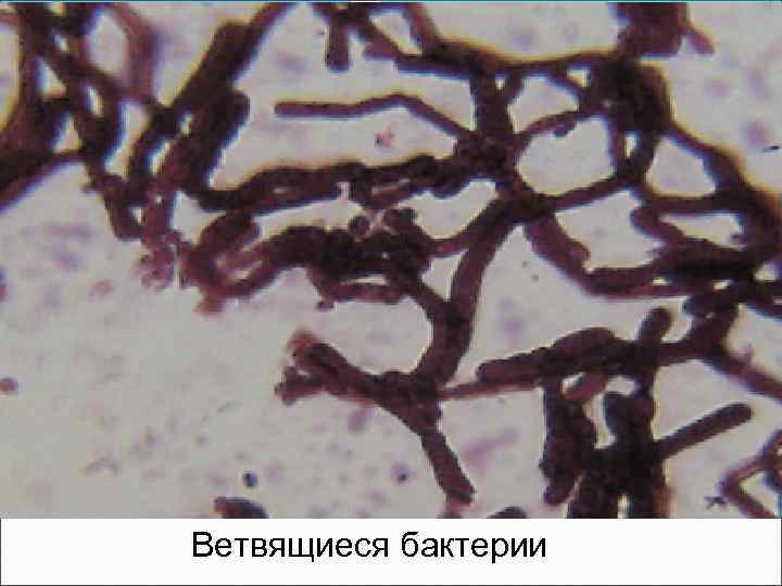 Нитевидные бактерии. Актиномицеты ветвящиеся бактерии. Нитчатые бактерии — актиномицеты. Нокардиоподобные актиномицеты. Ветвящиеся нитевидные формы бактерий.