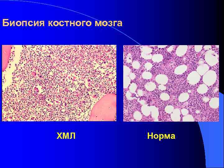 Пирог из костного мозга