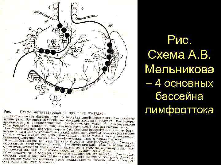 Лимфоотток селезенки схема