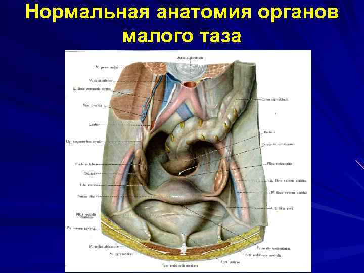 Органы таза у женщин. Органы малого таза. Анатомия органов малого таза. Анатомия малого таза женщины. Анатомия брюшной полости и малого таза у женщин.