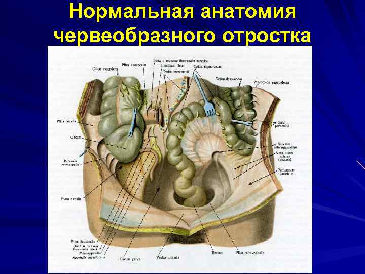 Нормальная анатомия червеобразного отростка 