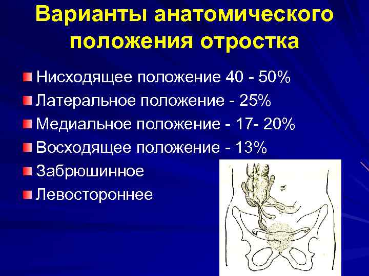 Варианты анатомического положения отростка Нисходящее положение 40 - 50% Латеральное положение - 25% Медиальное