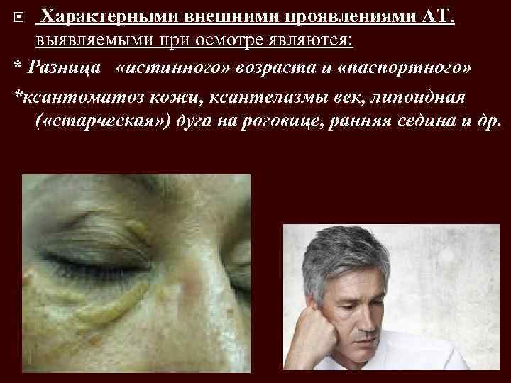 Характерными внешними проявлениями АТ, выявляемыми при осмотре являются: * Разница «истинного» возраста и «паспортного»