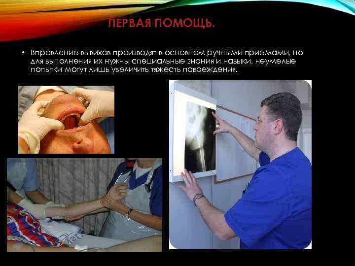 ПЕРВАЯ ПОМОЩЬ. • Вправление вывихов производят в основном ручными приемами, но для выполнения их