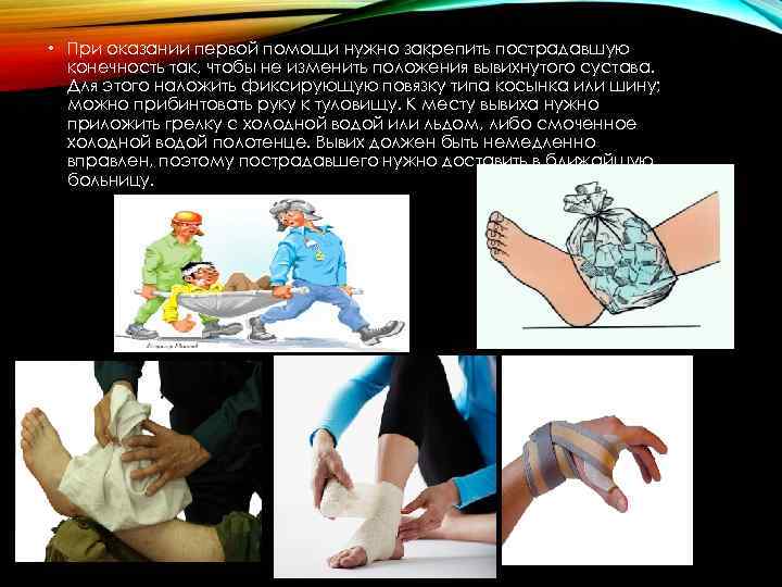  • При оказании первой помощи нужно закрепить пострадавшую конечность так, чтобы не изменить