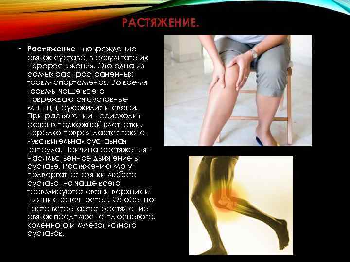 РАСТЯЖЕНИЕ. • Растяжение - повреждение связок сустава, в результате их перерастяжения. Это одна из