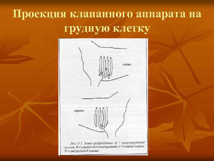 Проекция клапанного аппарата на грудную клетку 