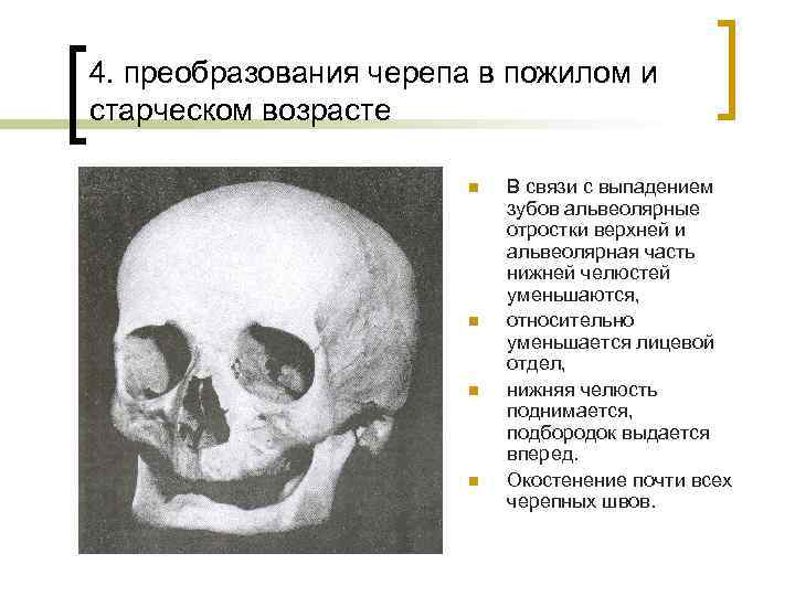 4. преобразования черепа в пожилом и старческом возрасте n n В связи с выпадением