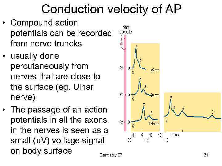 Conduction velocity of AP • Compound action potentials can be recorded from nerve truncks