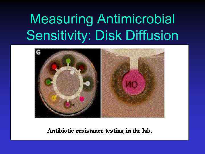 Measuring Antimicrobial Sensitivity: Disk Diffusion 
