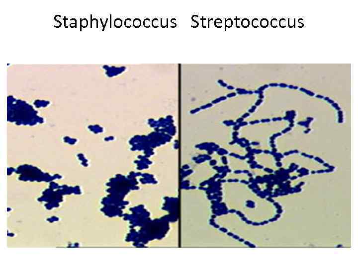 Staphylococcus Streptococcus 