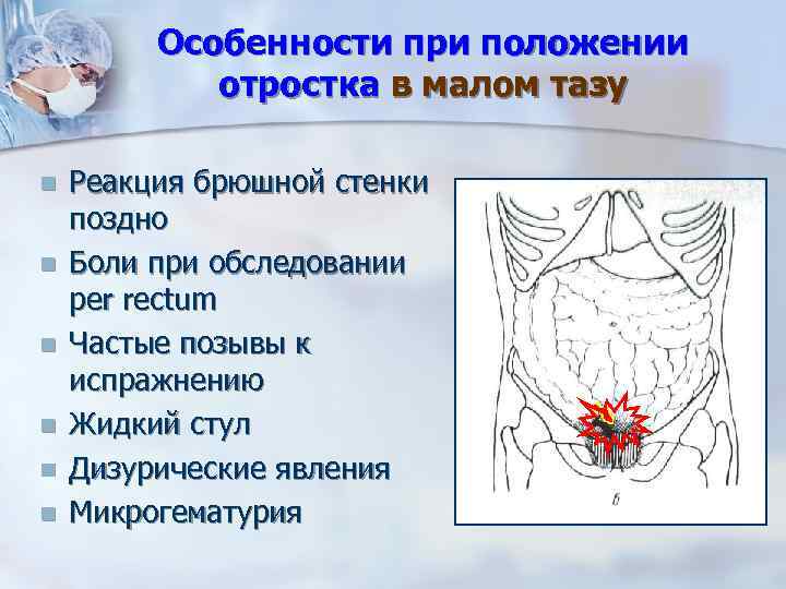 Особенности при положении отростка в малом тазу n n n Реакция брюшной стенки поздно