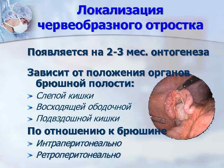 Локализация червеобразного отростка Появляется на 2 -3 мес. онтогенеза Зависит от положения органов брюшной