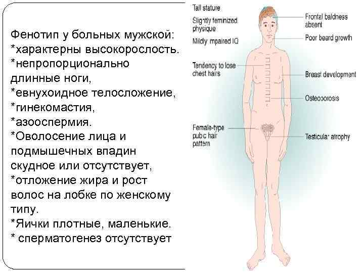 Фенотип у больных мужской: *характерны высокорослость. *непропорционально длинные ноги, *евнухоидное телосложение, *гинекомастия, *азооспермия. *Оволосение