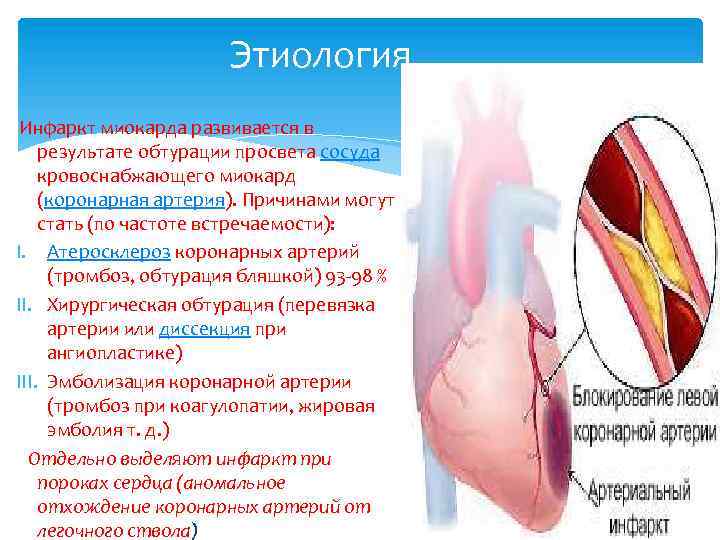 Этиология Инфаркт миокарда развивается в результате обтурации просвета сосуда кровоснабжающего миокард (коронарная артерия). Причинами