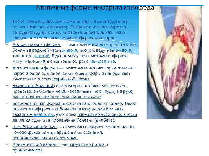 Атипичные формы инфаркта миокарда В некоторых случаях симптомы инфаркта миокарда могут носить атипичный характер.