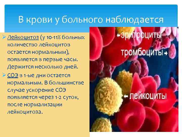 В крови у больного наблюдается Ø Лейкоцитоз (у 10 -11% больных количество лейкоцитов остается