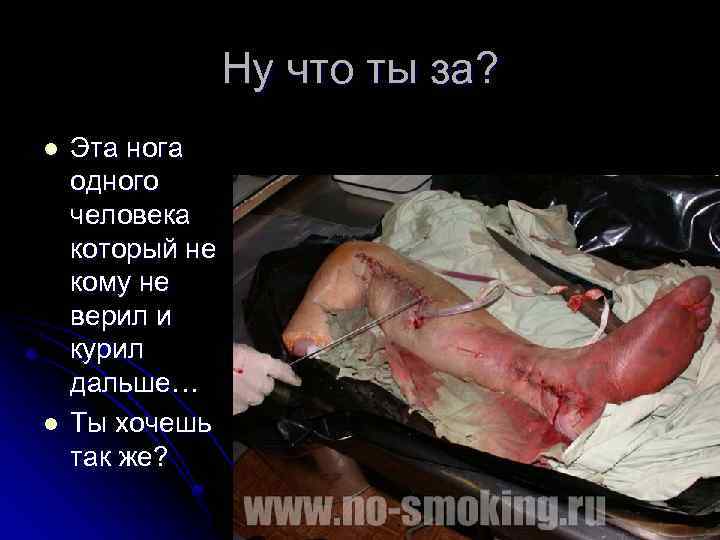 Ну что ты за? l l Эта нога одного человека который не кому не