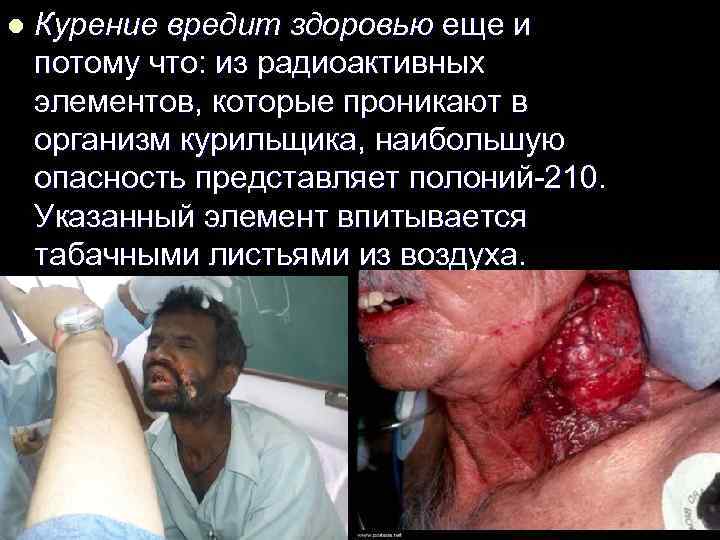 l Курение вредит здоровью еще и потому что: из радиоактивных элементов, которые проникают в