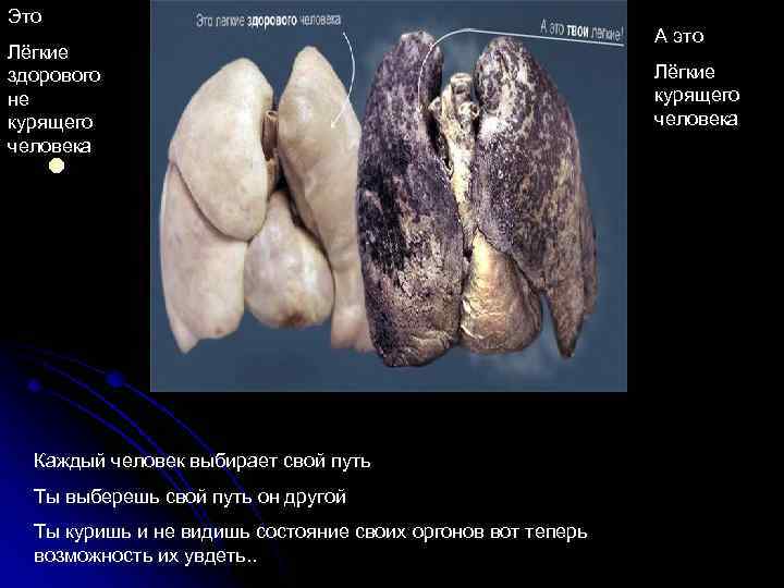 Это Лёгкие здорового не курящего человека l А это Каждый человек выбирает свой путь