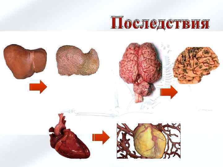 Последствия 