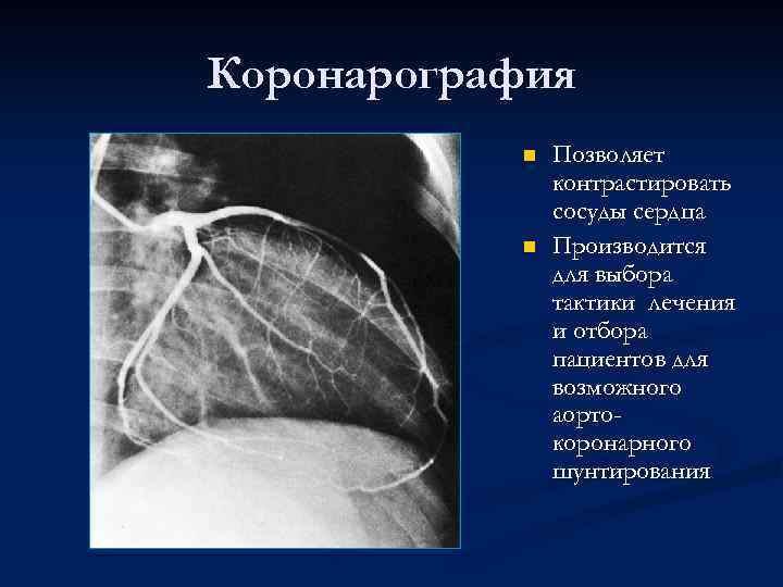 Коронарография n n Позволяет контрастировать сосуды сердца Производится для выбора тактики лечения и отбора
