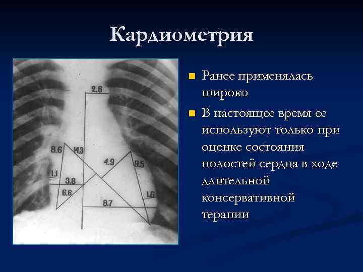 Кардиометрия n n Ранее применялась широко В настоящее время ее используют только при оценке