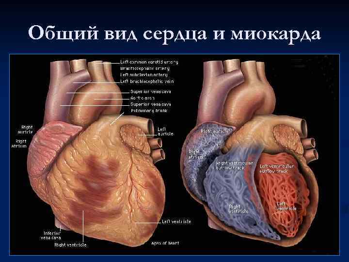 Общий вид сердца и миокарда 